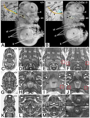 Hypoglossal Nerve Abnormalities as Biomarkers for Central Nervous System Defects in Mouse Lines Producing Embryonically Lethal Offspring